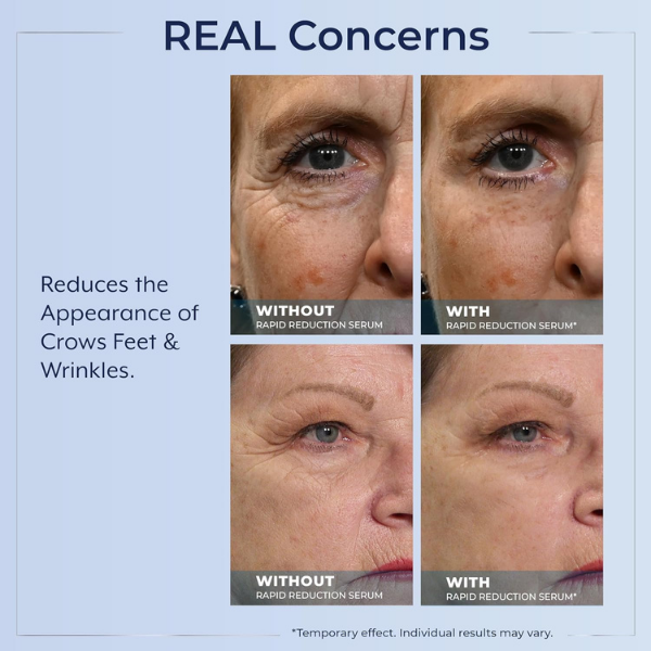 💧🌿Plexaderm Rapid Reduction Serum ✨Instant Skin Firming & Lifting