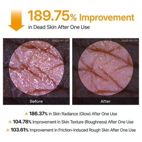 Peel Shot Keratin Care Kojic Acid Turmeric Spray - Exfoliating & Brightening Body Care