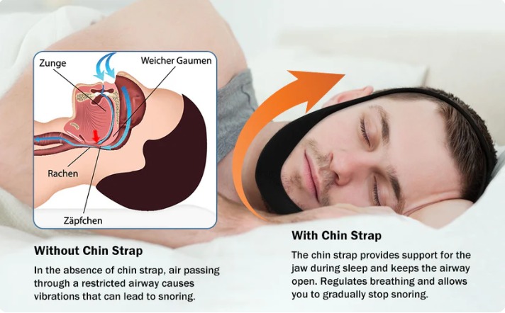 💥Last Day SALE 50% OFF💥AirFlow Jaw Strap