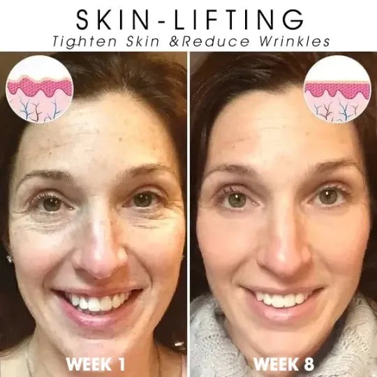 👩‍⚕️🔥Last Day Promotion 𝟕𝟎%𝐎𝐅𝐅 - SkinFirming Rejuvenating Serum🔥