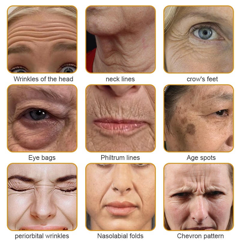 🐝🎁Made and Shipped from USA✨LOVILDS Bee Toxin Wrinkle Removal Cream-🔥LAST DAY 70% OFF
