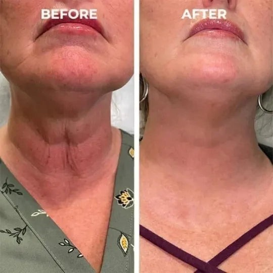 👩‍⚕️🔥Last Day Promotion 𝟕𝟎%𝐎𝐅𝐅 - SkinFirming Rejuvenating Serum🔥