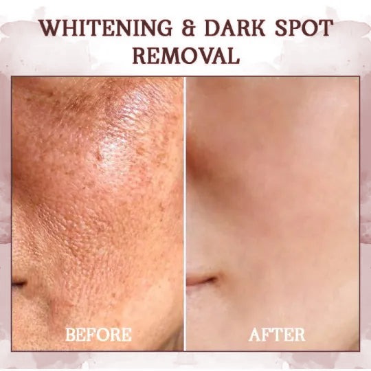 👩‍⚕️🔥Last Day Promotion 𝟕𝟎%𝐎𝐅𝐅 - SkinFirming Rejuvenating Serum🔥