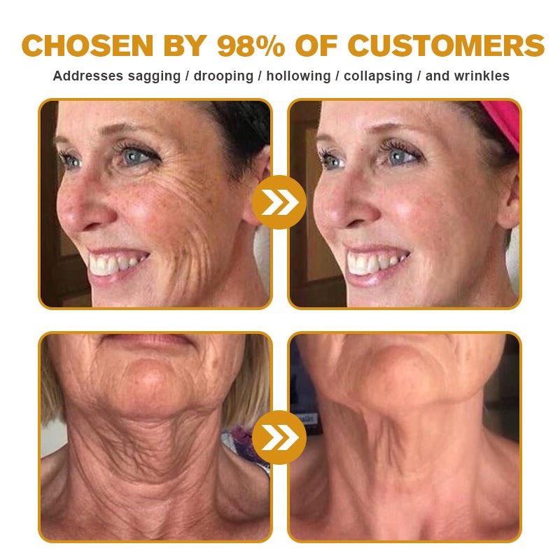 🐝🎁Made and Shipped from USA✨LOVILDS Bee Toxin Wrinkle Removal Cream-🔥LAST DAY 70% OFF