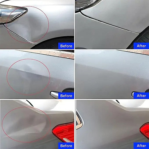 🔥FLASH SALE🔥DentFix Suction Cup Puller Kit🚗