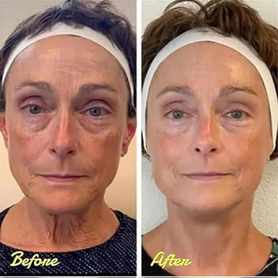 Experts Say This Instant Firm Eye Cream Is Actually Worth It