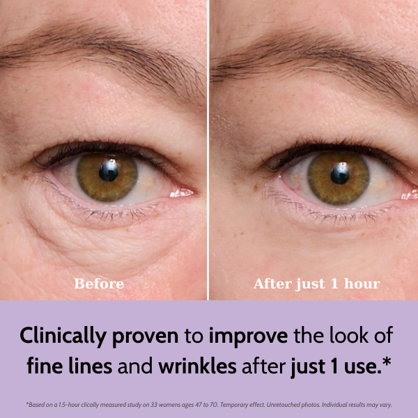 Peter Thomas Roth Instant FIRMx Collagen Infusion Tightening Eye Patches for Firming Under-Eye Bags & Wrinkles