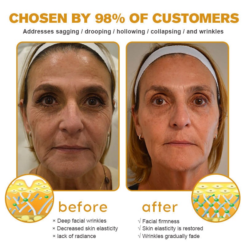 🐝🎁Made and Shipped from USA✨LOVILDS Bee Toxin Wrinkle Removal Cream-🔥LAST DAY 70% OFF