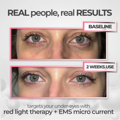 RevitalEyes Under-Eye Red Light Therapy