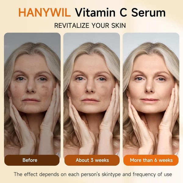 HANYWIL Super Vitamin C Serum - The Natural Way to Brighter, Smoother, and Ageless Skin
