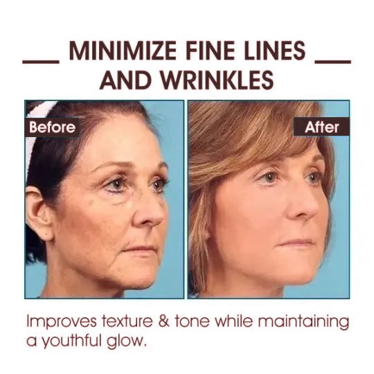 👩‍⚕️🔥Last Day Promotion 𝟕𝟎%𝐎𝐅𝐅 - SkinFirming Rejuvenating Serum🔥