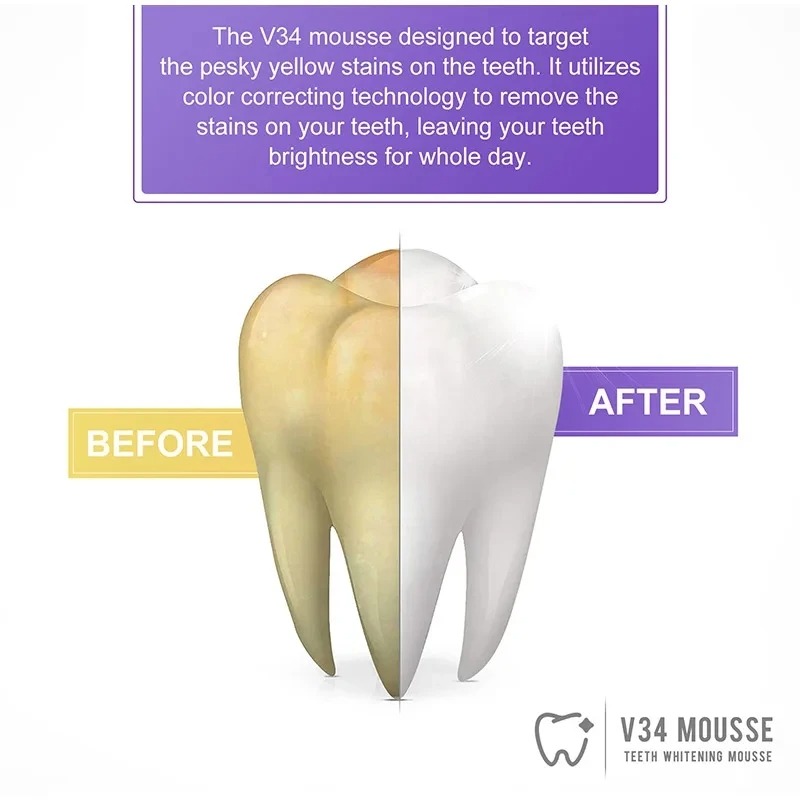 Hismile V34 Color Corrector Serum – Achieve a Brighter, Whiter Smile