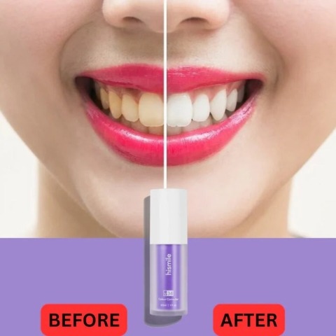 Hismile V34 Color Corrector Serum – Achieve a Brighter, Whiter Smile