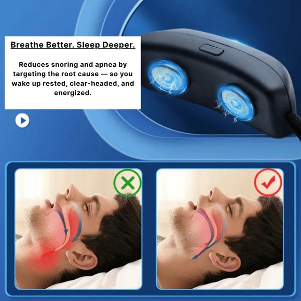 Sleep Clear | Anti Snoring Neurostimulation Device