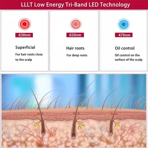 Spartan Red Light Growth Cap – 272 Medical-Grade Lasers, 12-Minute Daily Hair Regrowth