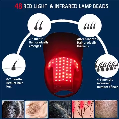 Spartan Red Light Growth Cap – 272 Medical-Grade Lasers, 12-Minute Daily Hair Regrowth