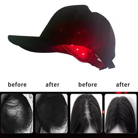 Spartan Red Light Growth Cap – 272 Medical-Grade Lasers, 12-Minute Daily Hair Regrowth
