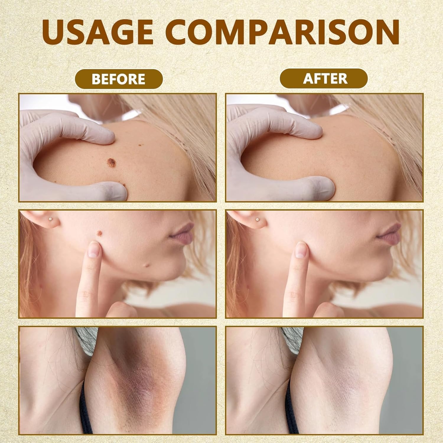 BeeRx™ Bee Venom Cream - The Natural Secret to Ageless, Healthy Skin