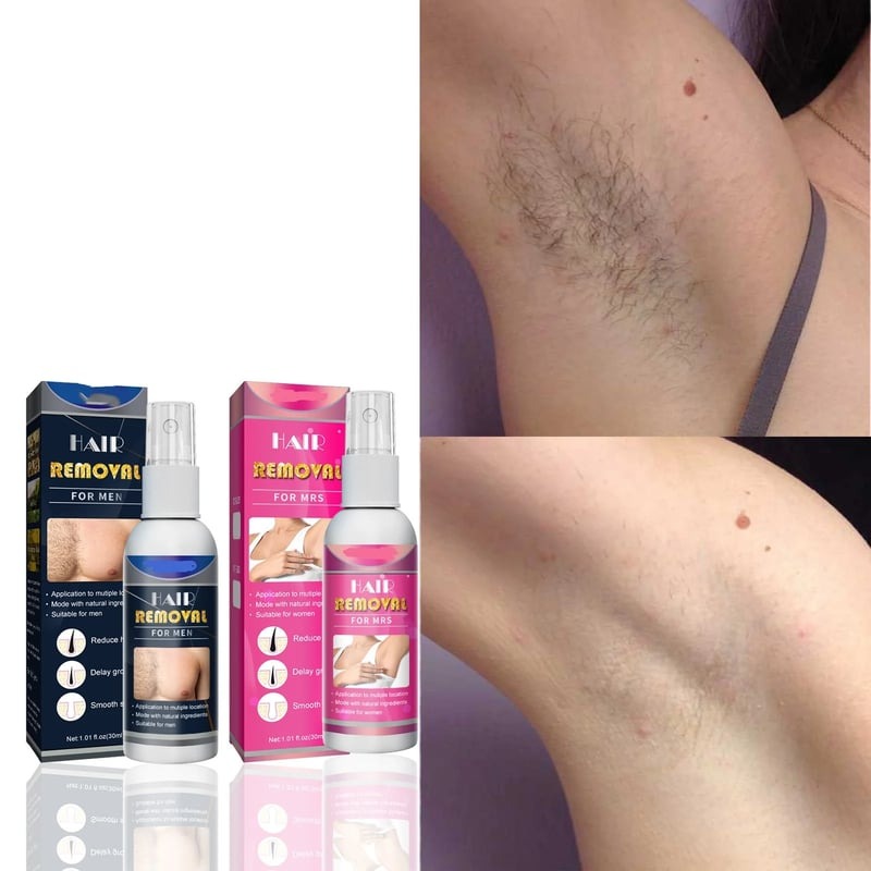 🔥Last Day Promotion 50% OFF🔥Body Hair Removal Spray
