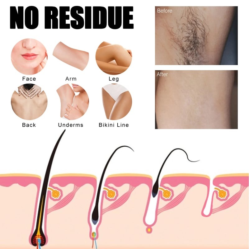 🔥Last Day Promotion 50% OFF🔥Body Hair Removal Spray