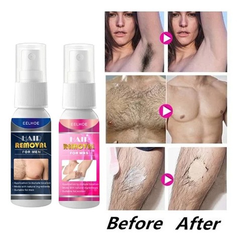🔥Last Day Promotion 50% OFF🔥Body Hair Removal Spray